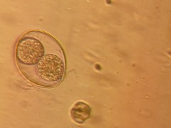 Imagen de microscopio ANALISIS DE HECES DE UN CACHORRO. COCCIDIO, parásito intestinal